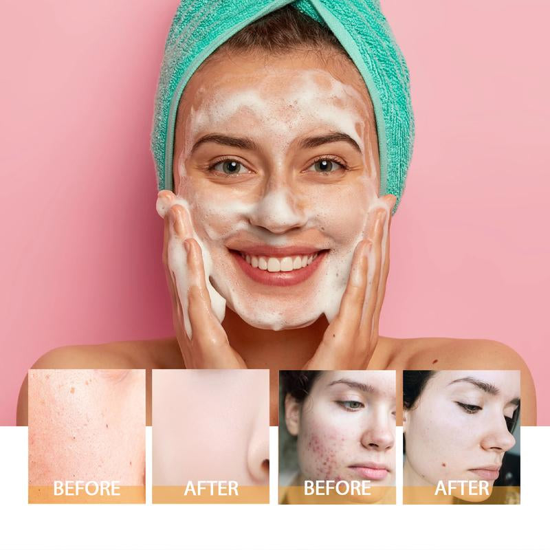 Turmeric Wash and Care Turmeric Ceansing Mousse, Facialcleansing Skincare Facialcleansing Cleanserfacial Wash