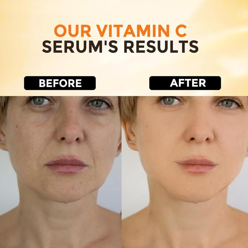 Vitamin C Facial Serum&Hyaluronic Acid Serum, Daily Skincare Product, Skincare Comfort,Daily Care Set Facial Essence